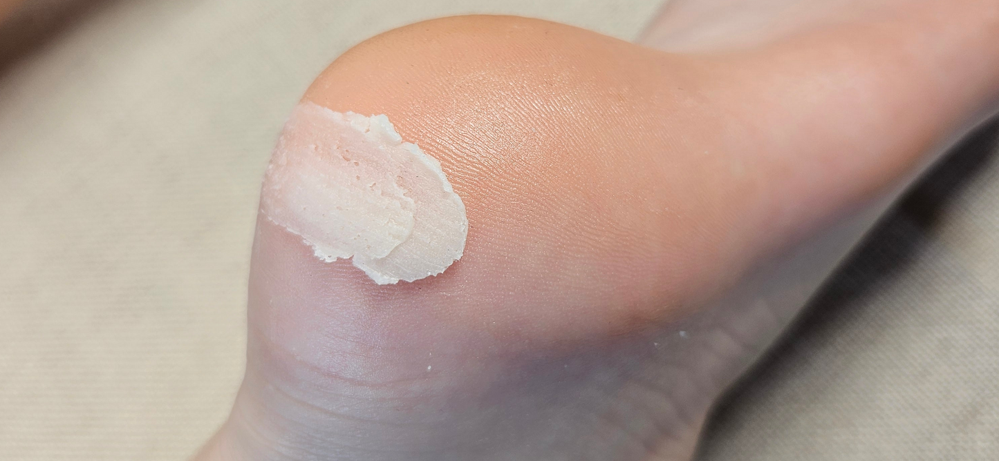 Sweet Soles Citrus Lemongrass Feet Balm – Dry Cracked Heels Deeply Nourishing Foot Care